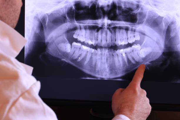 Best Emergency Denture Repair in Sugarland Run, VA
